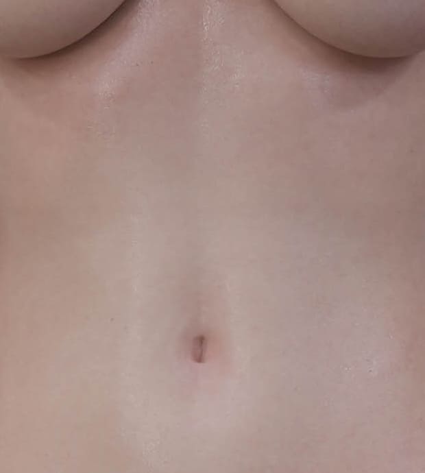 Natural